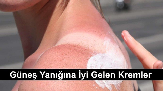 güneş yanığına iyi gelen kremler